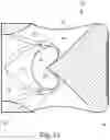 Fig. 10 - Flow diverter