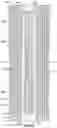 Fig. 12 - Utilizing electrically actuated explosives downhole
