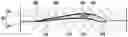 Fig. 01 - Composite vane with metal reinforcement, and its method of manufacture