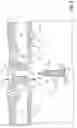 Fig. 09 - Fuel injector with duct assembly