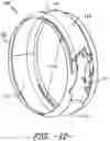 Fig. 08 - Casing having a non-axisymmetric composite wall