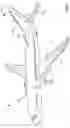 Fig. 02 - Apparatus and methods to deploy a fluid flow channel