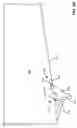 Fig. 09 - Apparatus and methods to deploy a fluid flow channel
