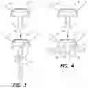 Fig. 03 - Combination securing clips