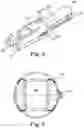 Fig. 06 - Lighted nock
