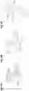 Fig. 14 - Method and apparatus to manipulate biological sections