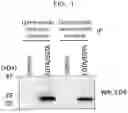Fig. 02 - Method for recovering extracellular vesicles