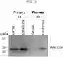 Fig. 05 - Method for recovering extracellular vesicles