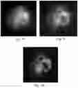 Fig. 07 - Device and method for imaging shortwave infrared fluorescence