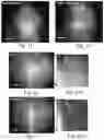 Fig. 08 - Device and method for imaging shortwave infrared fluorescence