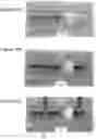 Fig. 11 - APPARATUSES, METHODS AND SYSTEMS FOR AUTOMATED PROCESSING OF NUCLEIC ACIDS AND ELECTROPHORETIC SAMPLE PREPARATION