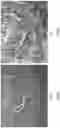 Fig. 11 - HIGH PRECISION MICROPURIFICATION SYSTEM AND METHODS OF USE