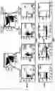 Fig. 05 - RESIDUAL DISEASE DETECTION IN MULTIPLE MYELOMA