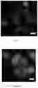 Fig. 10 - Methods for diagnosing neoplastic lesions