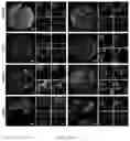 Fig. 12 - Methods for diagnosing neoplastic lesions