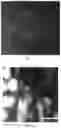 Fig. 13 - Methods for diagnosing neoplastic lesions
