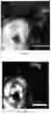 Fig. 15 - Methods for diagnosing neoplastic lesions