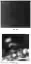 Fig. 16 - Methods for diagnosing neoplastic lesions