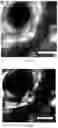 Fig. 18 - Methods for diagnosing neoplastic lesions