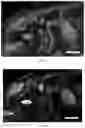 Fig. 25 - Methods for diagnosing neoplastic lesions