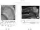 Fig. 27 - Methods for diagnosing neoplastic lesions