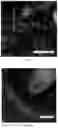Fig. 37 - Methods for diagnosing neoplastic lesions