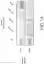 Fig. 11 - Compositions and methods for screening and identifying clinically aggressive prostate cancer