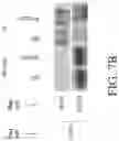 Fig. 12 - Compositions and methods for screening and identifying clinically aggressive prostate cancer