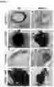 Fig. 02 - METHOD FOR THE PROGNOSIS OF SURVIVAL TIME OF A PATIENT SUFFERING FROM A SOLID CANCER