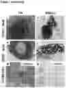 Fig. 03 - METHOD FOR THE PROGNOSIS OF SURVIVAL TIME OF A PATIENT SUFFERING FROM A SOLID CANCER