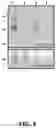 Fig. 09 - Cleavable probes for isotope targeted glycoproteomics and methods of using the same