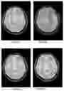 Fig. 04 - Magnetic resonance imaging method and device