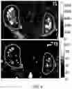 Fig. 05 - System and method for dynamic multiple contrast enhanced, magnetic resonance fingerprinting (DMCE-MRF)