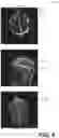 Fig. 10 - Systems and methods for automated graphical prescription with deep neural networks