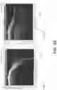 Fig. 05 - Forming a composite down sonar image