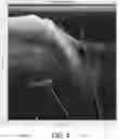 Fig. 06 - Forming a composite down sonar image