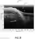 Fig. 10 - Forming a composite down sonar image