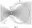 Fig. 12 - Nanograting method and apparatus