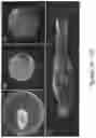 Fig. 04 - LIGHT SHEET IMAGING WITH ACOUSTIC TRAPPING