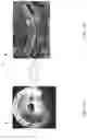 Fig. 04 - Apparatus and method for prevention of contamination on collector of extreme ultraviolet light source