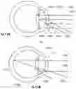 Fig. 08 - Apparatus for eye tracking
