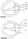 Fig. 11 - Apparatus for eye tracking
