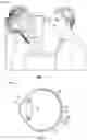 Fig. 02 - Augmented and virtual reality display systems and methods for diagnosing health conditions based on visual fields
