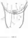 Fig. 11 - Slip-resistant eyewear system