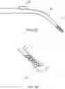 Fig. 20 - Slip-resistant eyewear system
