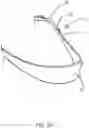 Fig. 43 - Slip-resistant eyewear system