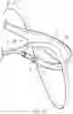 Fig. 53 - Slip-resistant eyewear system