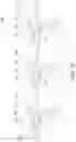Fig. 11 - Watch component, movement, watch and method for manufacturing watch component