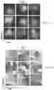 Fig. 05 - Complex-valued neural network with learnable non-linearities in medical imaging