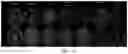 Fig. 08 - Complex-valued neural network with learnable non-linearities in medical imaging